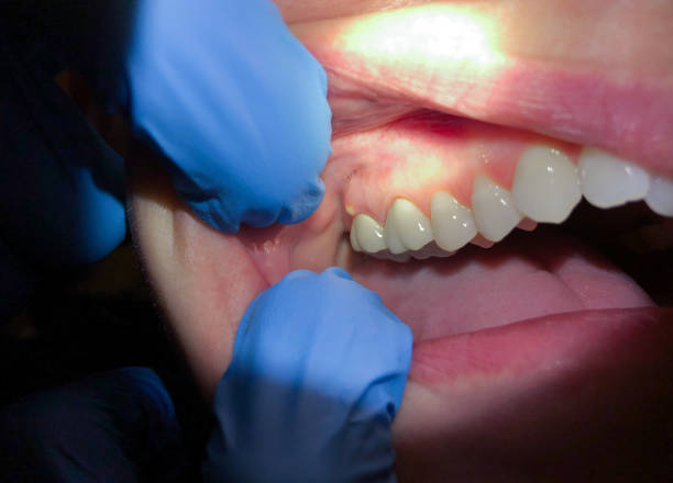 Best Mobile Emergency Dentist in Frankfort Square, IL